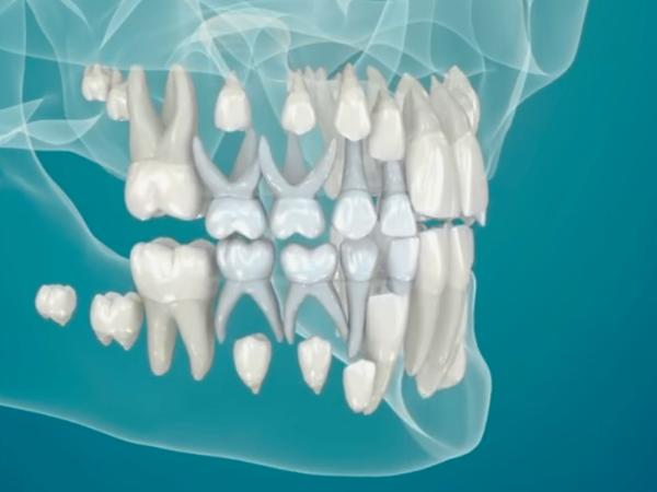 마곡역치과_3. 학령기,청소년(8~18세) 충치 증가 이유와 구강관리 핵심 관련 이미지 1