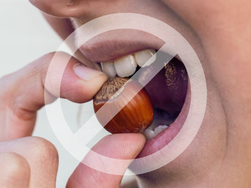 마곡역치과_5. 글래스아이오노머(GI) 치료 후 주의사항 관련 이미지 1