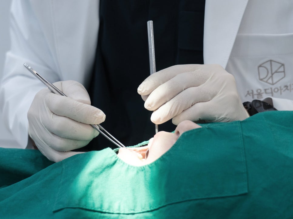 마곡동치과_ &ldquo;치아본만 잘 떠도 반은 성공!&rdquo; [3. 인상채득 진행 과정] 관련 이미지 1