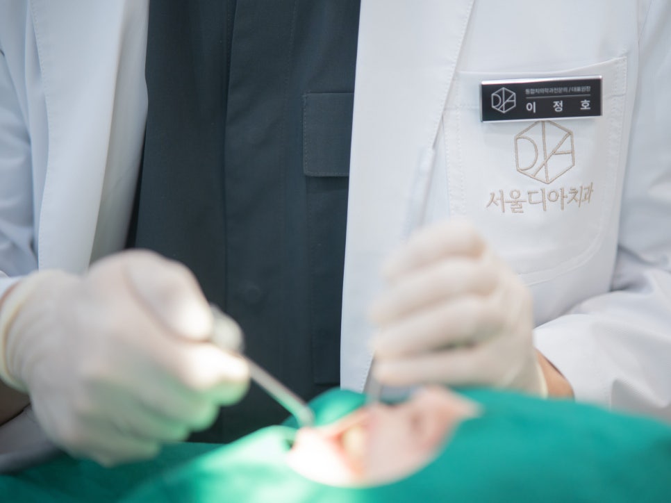 Maggok Dental_4. Is it over once the jawbone has melted away? How to save natural teeth with guided tissue regeneration (GTR) image 7