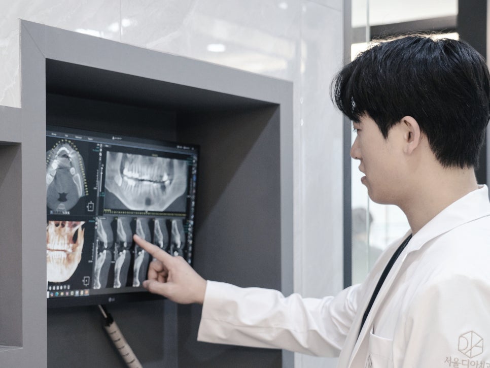 마곡역치과_&ldquo;치아는 살리고 충치만 잡는다" [ 어금니 레진 치료 과정 ] 관련 이미지 1