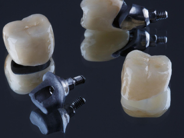 Magok Dental Clinic_ 5. A Complete Guide to Full-Mouth Implant Prices: How Much Will I Actually Pay? image 4