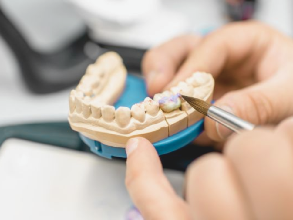 마곡동치과_당일 인레이 치료 과정 관련 이미지 2