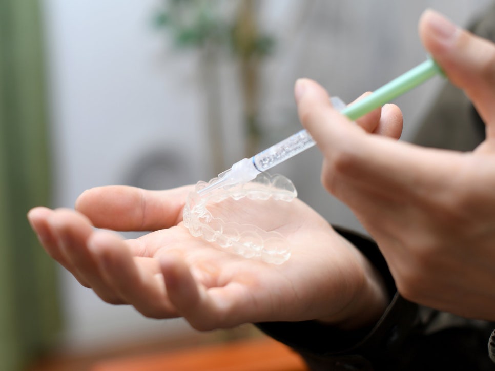 마곡역치과_ &ldquo;집에서 하얀 치아 만들기!&rdquo;[3. 생활치 자가미백 치료 특징과 과정 ] 관련 이미지 1