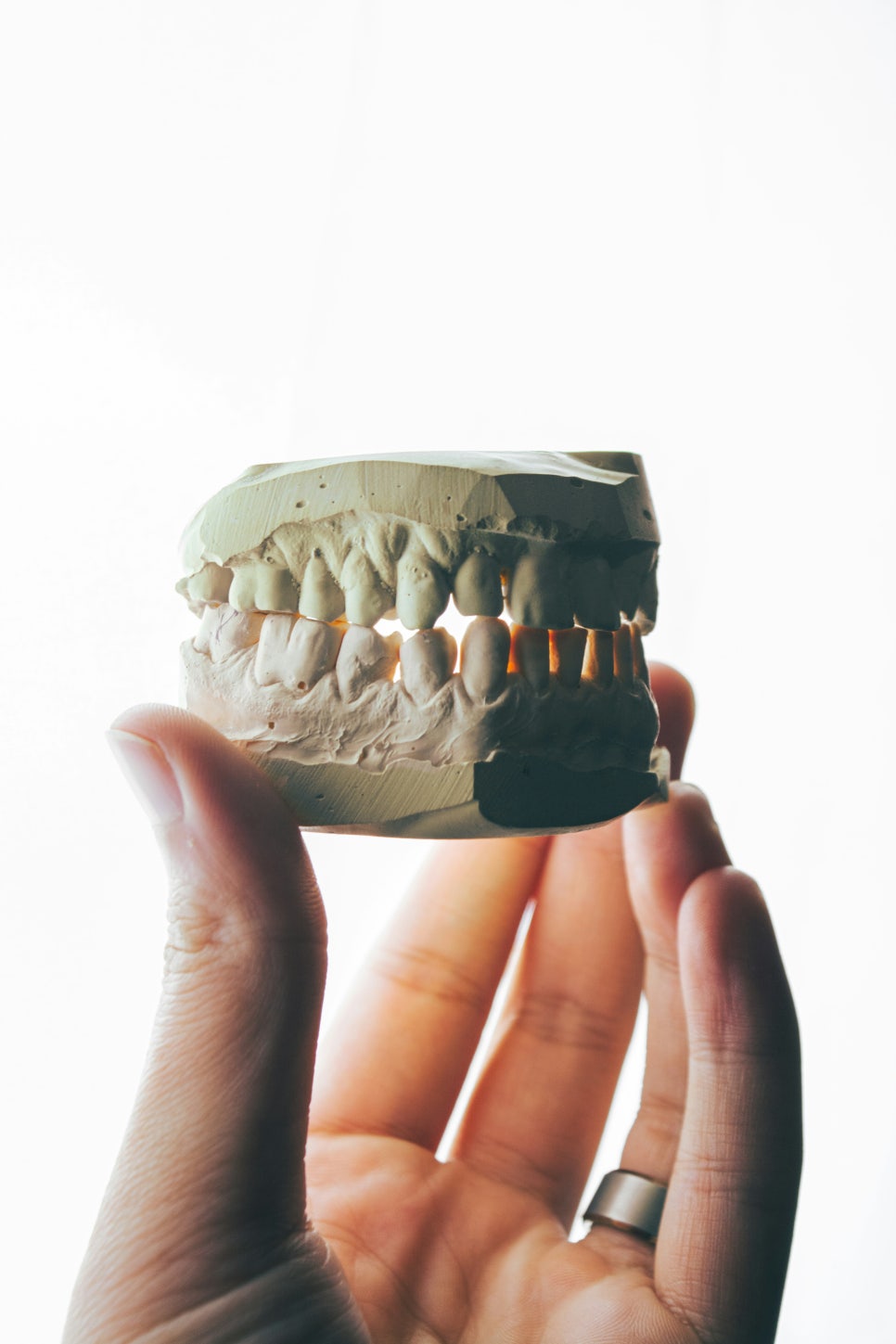 [ Magok Veneers_07 ] Veneer Failure Cases: Be Careful in These Situations image 2