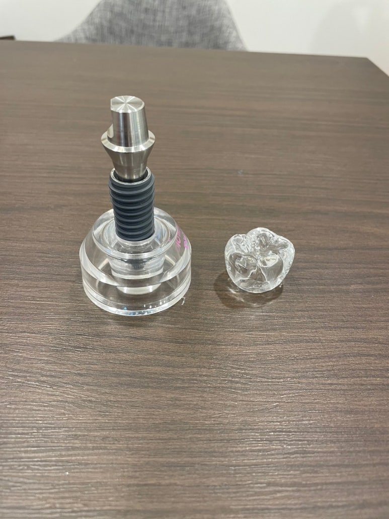 [서울시청역치과] 다른 치과에서 오래전에 한 임플란트가 흔들려요 &rarr;재수술 케이스 관련 이미지 3