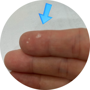 서울에서 치아미백 하는 치과 찾고 계신가요? 해외에서도 미백하러 오는 시청역 치과 미백비용 관련 이미지 4