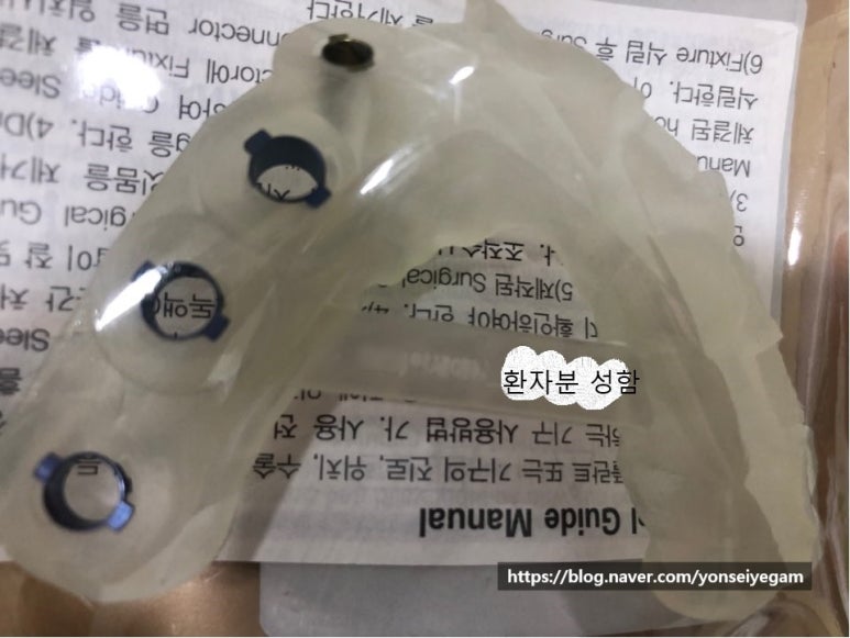 [시청역/서울역]네비게이션인플란트를 이용한 여러개 임플란트 과정 관련 이미지 7