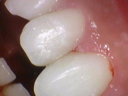 외국인치과 해외에서도 치과공포증환자들이 찾아오는 치과입니다. 관련 이미지 4