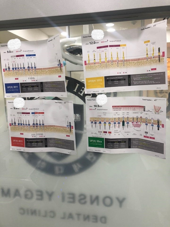 [시청역/서울역]네비게이션인플란트를 이용한 여러개 임플란트 과정 관련 이미지 9