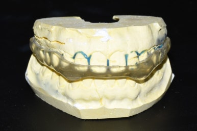 이갈이 소리 안나는 법. 치아 건강과 룸메이트 또는 배우자분의 평안을 위해서! 관련 이미지 1