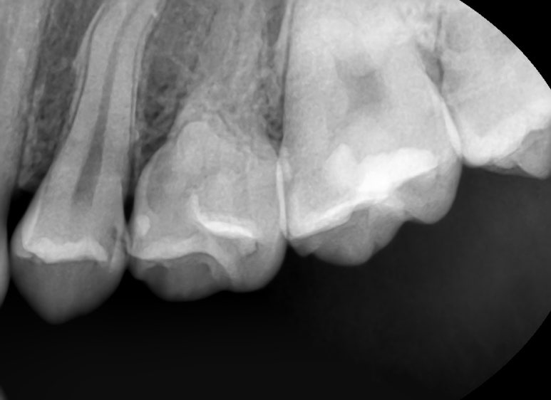 순화동 가까운 충치치료 치과 해외에서도 찾아오는 연세 예감 치과 관련 이미지 5