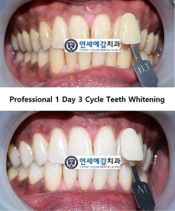 an English Speaking Dentist in Seoul; Welcome to Yonsei Yegam Dental Clinic (City Hall Station)! 관련 이미지 7