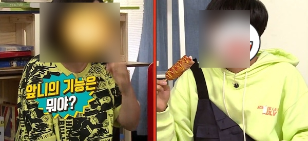 치과의사는 가족에게는 라미네이트 안한다고요? 저희 치과의사선생님은 본인 이에 직접 "프리네이트"하셨어요! 관련 이미지 2