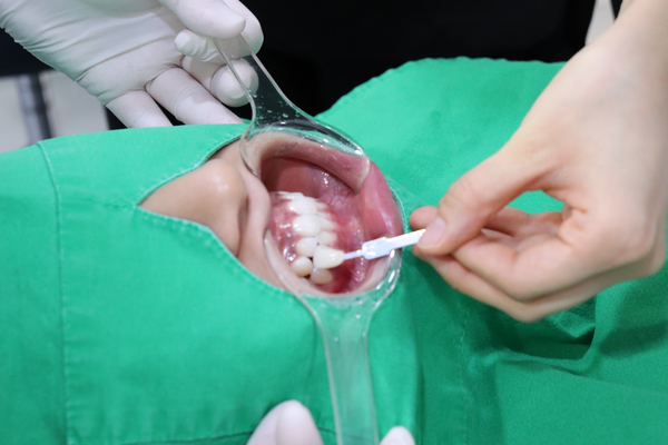 Yonsei Yegam Dental Clinic (City Hall Station, Seoul)-Teeth cleaning, Whitening Review 관련 이미지 13