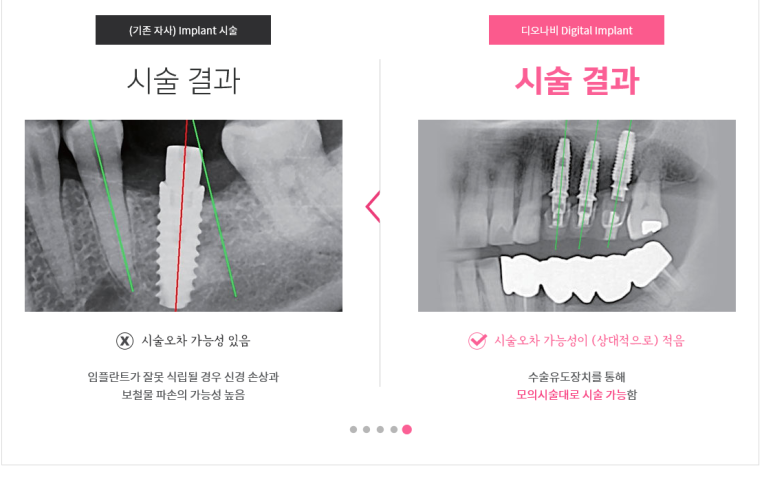 시청역 광화문 겁많은 사람들에게 딱 좋은 내비게이션 임플란트 치과 관련 이미지 12