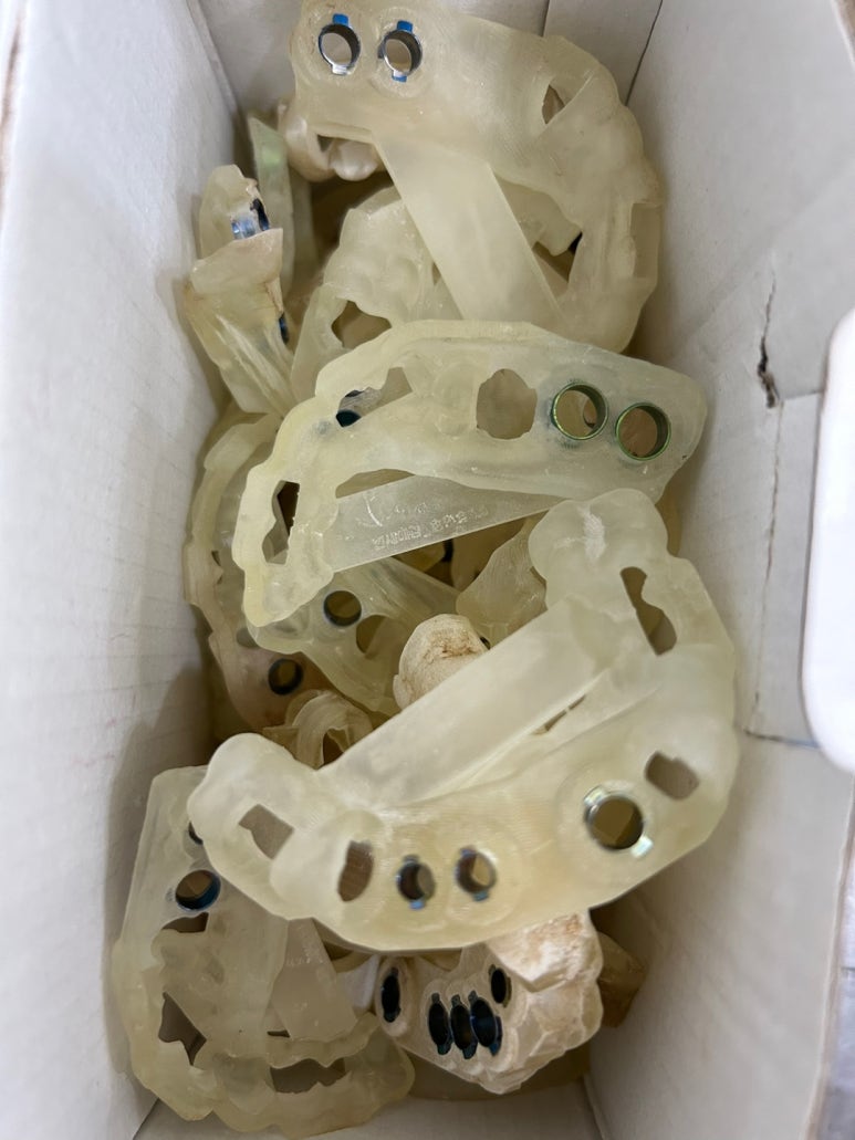 마포 임플란트가 너무 무서워요 하는 분들 잇몸절개하지 않는 네비게이션임플란트 소개해드립니다 관련 이미지 20