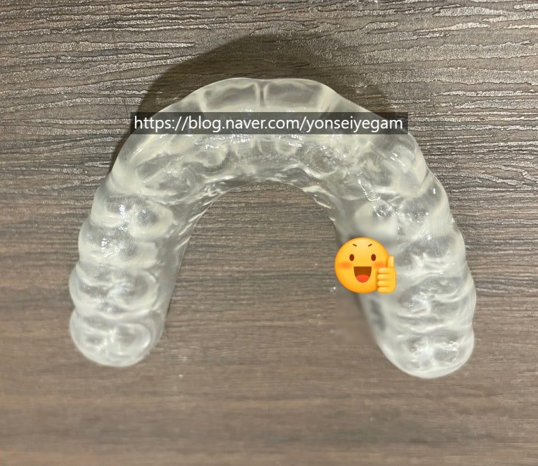 이갈이가 있다면? 이갈이 장치, 그냥 인터넷으로 사서 해도 되나요?/치과 이갈이장치 비용안내 관련 이미지 2