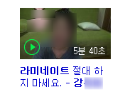 치과의사는 가족에게는 라미네이트 안한다고요? 저희 치과의사선생님은 본인 이에 직접 "프리네이트"하셨어요! 관련 이미지 4