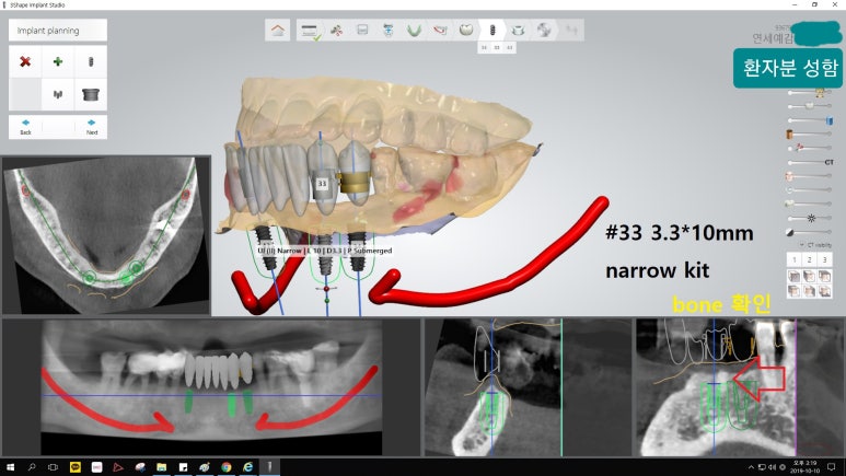 [시청역/을지로] 임플란트 진단 상담 비용? 관련 이미지 8