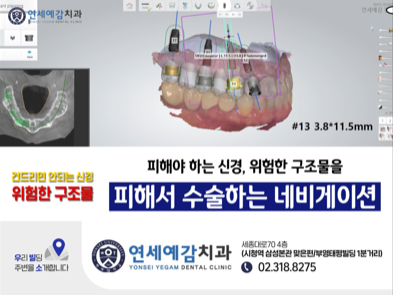 충정로 내비게이션 임플란트 알려드려요 관련 이미지 4