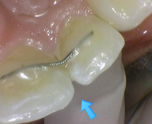 외국인치과 해외에서도 치과공포증환자들이 찾아오는 치과입니다. 관련 이미지 9