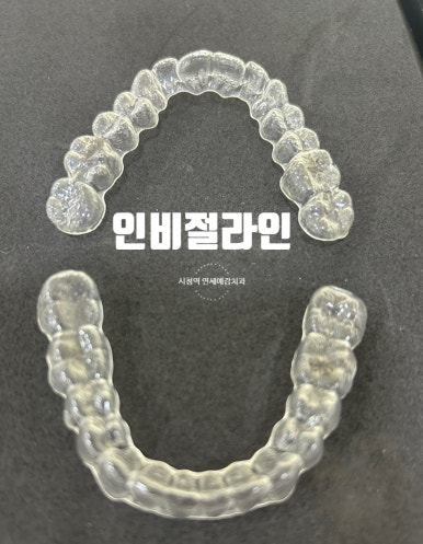 시청역 연세예감 치과 환자분께서 투명교정 후기 남겨주셨어요 관련 이미지 4