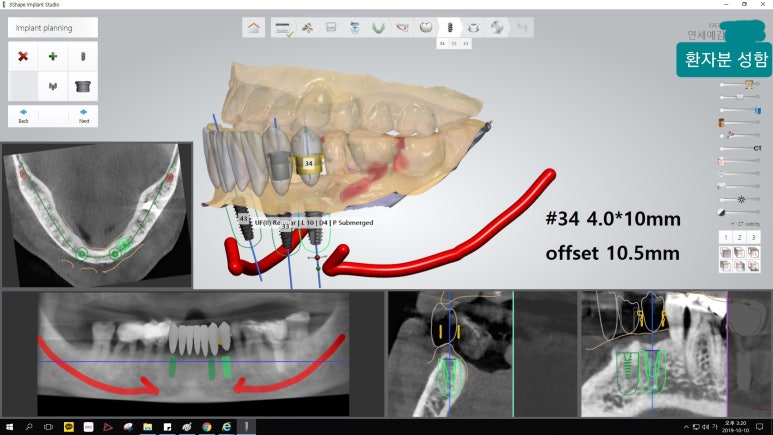 [시청역/을지로] 임플란트 진단 상담 비용? 관련 이미지 9