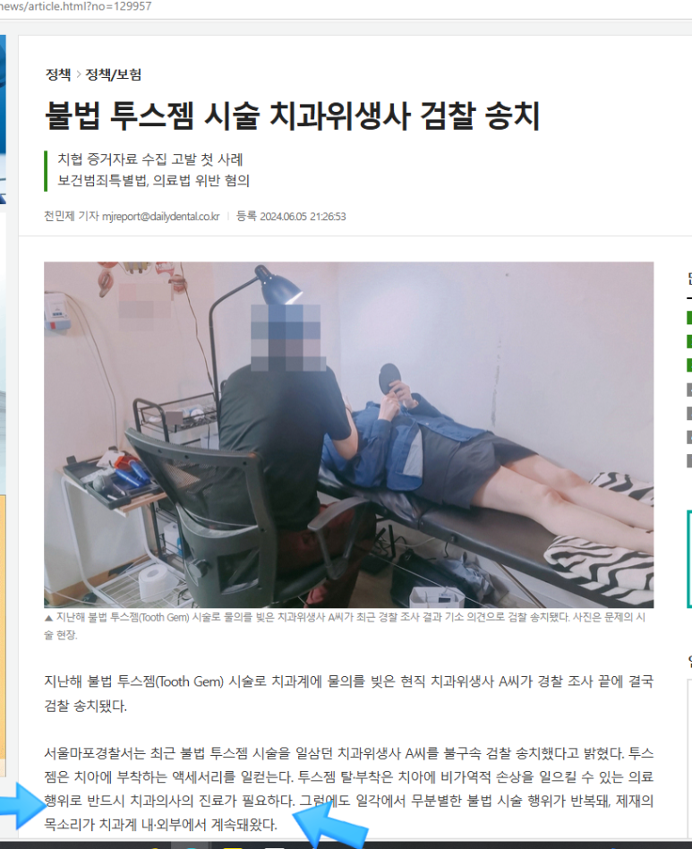 투쓰젬(Tooth gem),굳이 한다면 꼭 치과에서! 이유&비용,실제 치과에서 한 사진까지! 관련 이미지 3