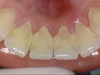 종합건강검진/강북삼성병원 서울종합검진센터 가는길/종합건진센터/연세예감치과 스케일링 안내 관련 이미지 9