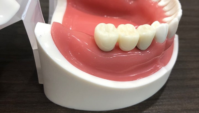 시청역 연세예감치과 디지털임플란트우수시술병원 선정 & 네비게이션 임플란트 관련 이미지 9