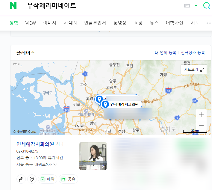 1.송곳니를 다른 앞니 모양 라미네이트로, 2.치아사이 빈공간을 라미네이트로 관련 이미지 9