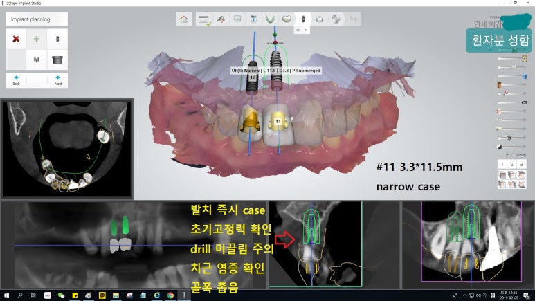 [시청역/을지로] 임플란트 진단 상담 비용? 관련 이미지 7