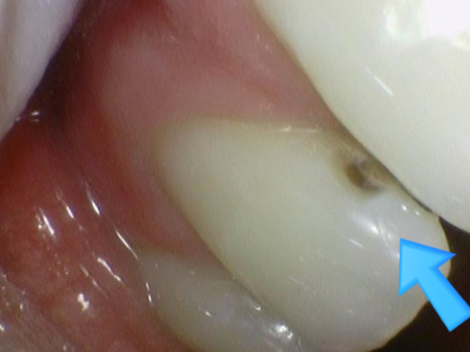 외국인치과 해외에서도 치과공포증환자들이 찾아오는 치과입니다. 관련 이미지 7