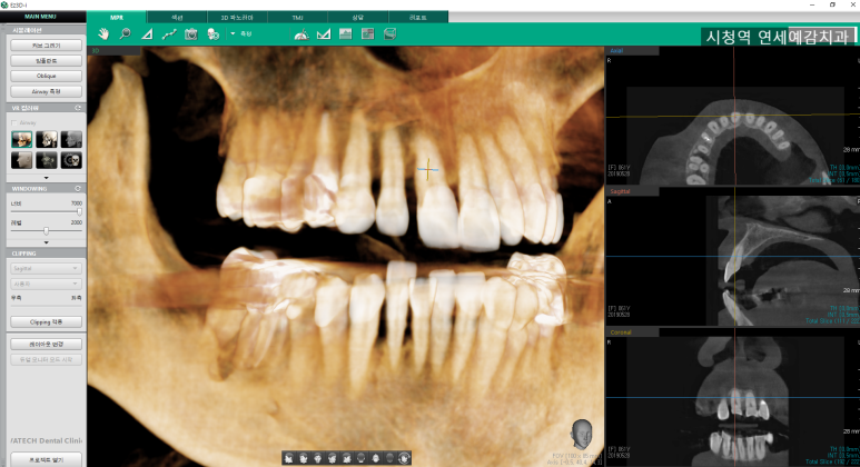 [시청역/을지로] 임플란트 진단 상담 비용? 관련 이미지 2