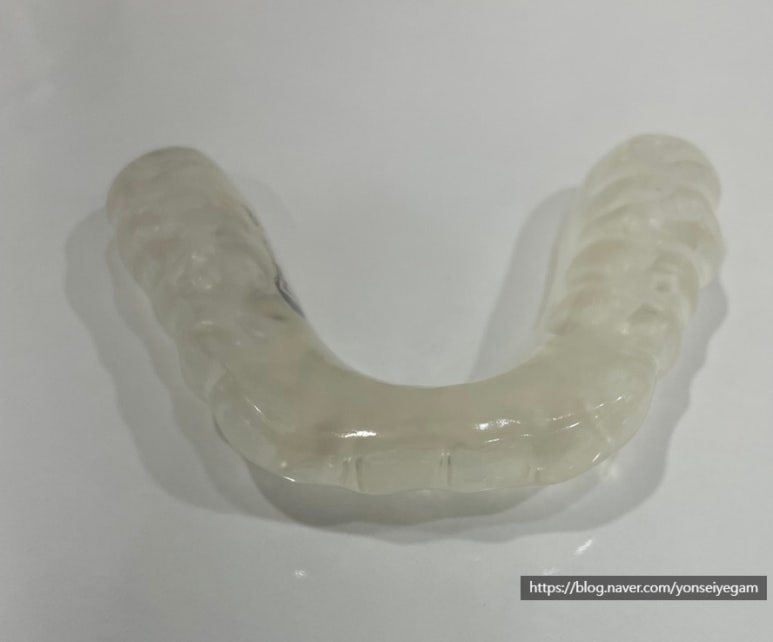 [서울역/광화문]이갈이 심하다면? 이갈이보톡스 어떠세요? 이갈이 보톡스, 이갈이 장치 관련 이미지 6