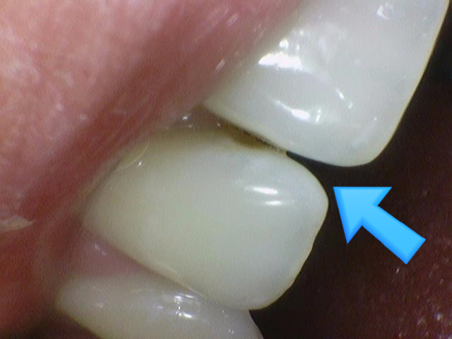 외국인치과 해외에서도 치과공포증환자들이 찾아오는 치과입니다. 관련 이미지 6