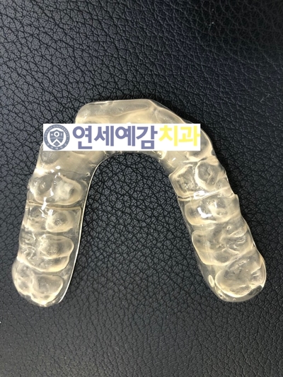 이갈이 방지 장치/마우스피스?/이갈이 보톡스 알려드려요 관련 이미지 2