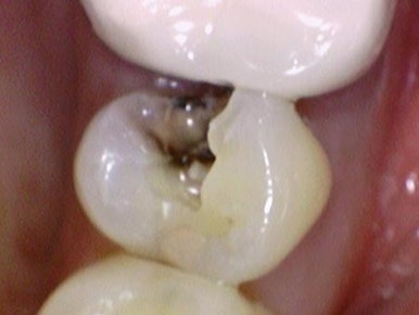 시청역치과 객관적인 근거로 치료하며, 환자분께 치료 전 치료해야하는 이유를 보여드립니다. 관련 이미지 3