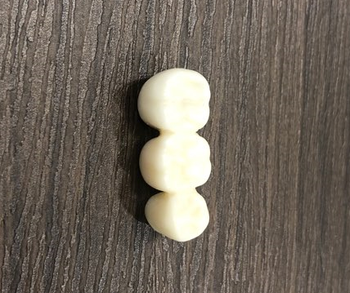 시청역 연세예감치과 디지털임플란트우수시술병원 선정 & 네비게이션 임플란트 관련 이미지 7