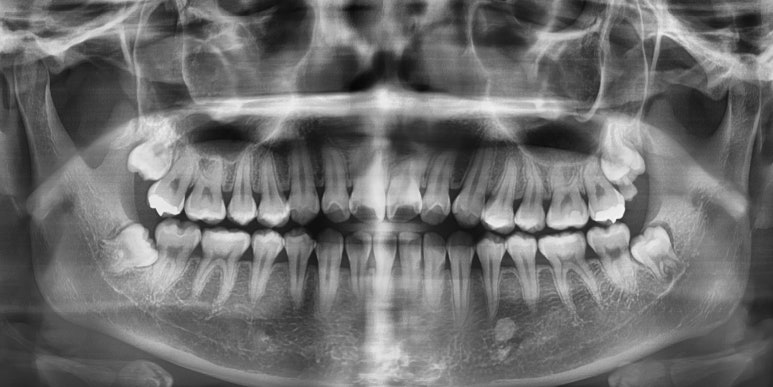 시청역 국가지정 구강검진기관/직장인치과검진/연세예감치과/당일 제출용 검진결과 발급가능 관련 이미지 5