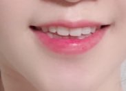 치과의사는 가족에게는 라미네이트 안한다고요? 저희 치과의사선생님은 본인 이에 직접 "프리네이트"하셨어요! 관련 이미지 11