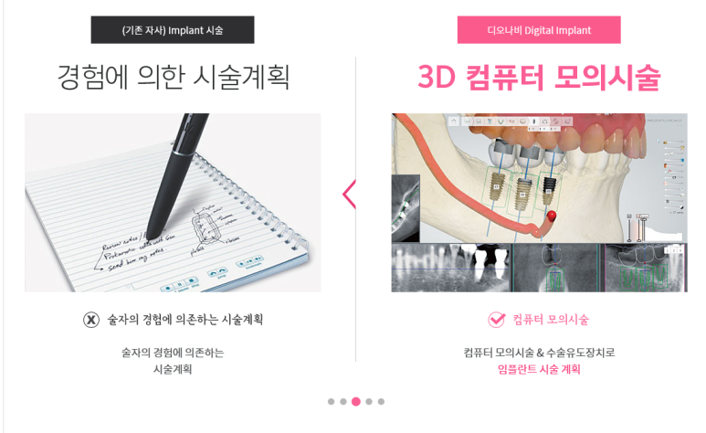 서대문역 가까운 치과 비절개 네비게이션임플란트 소개;덜아프게 빠른 회복위한 관련 이미지 5