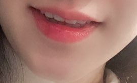 치과의사는 가족에게는 라미네이트 안한다고요? 저희 치과의사선생님은 본인 이에 직접 "프리네이트"하셨어요! 관련 이미지 9