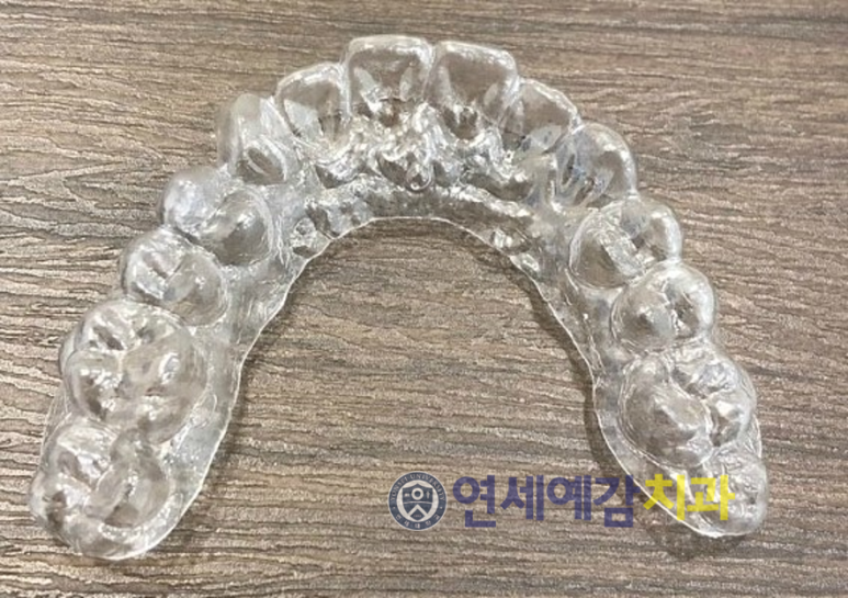 [시청역치과/서소문치과]세계에서 외국인 환자가 찾아오는 시청역치과 연세예감치과 관련 이미지 3