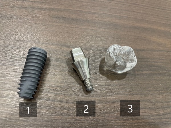 [서울시청역] 시청치과 하루만에 완성 임플란트 가능한가요? 관련 이미지 4