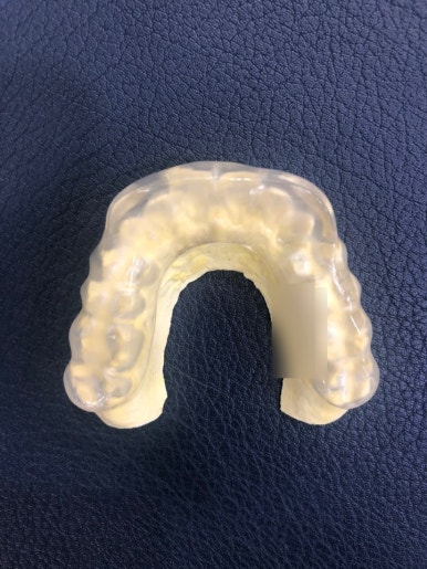 [서울] 이갈이보톡스, 이갈이장치, 턱관절 보톡스,사각턱 보톡스, 관자놀이보톡스 안내 관련 이미지 5