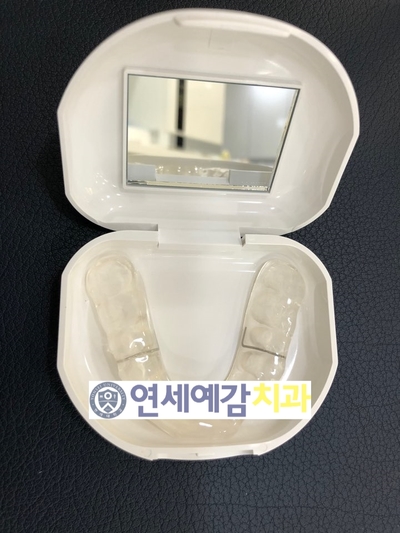 이갈이 방지 장치/마우스피스?/이갈이 보톡스 알려드려요 관련 이미지 3