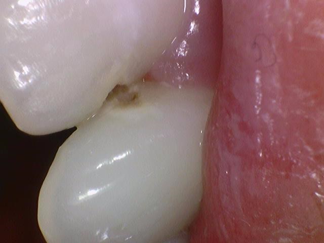 외국인치과 해외에서도 치과공포증환자들이 찾아오는 치과입니다. 관련 이미지 2