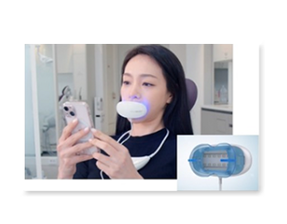 치아미백으로 해외에서도 찾아오는 치과가 서울에 있다고??!! 관련 이미지 9